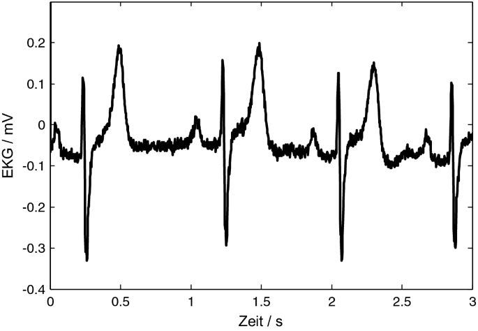 Detail Nulllinie Ekg Nomer 12