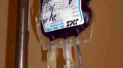 Detail Foto Transfusi Darah Nomer 47