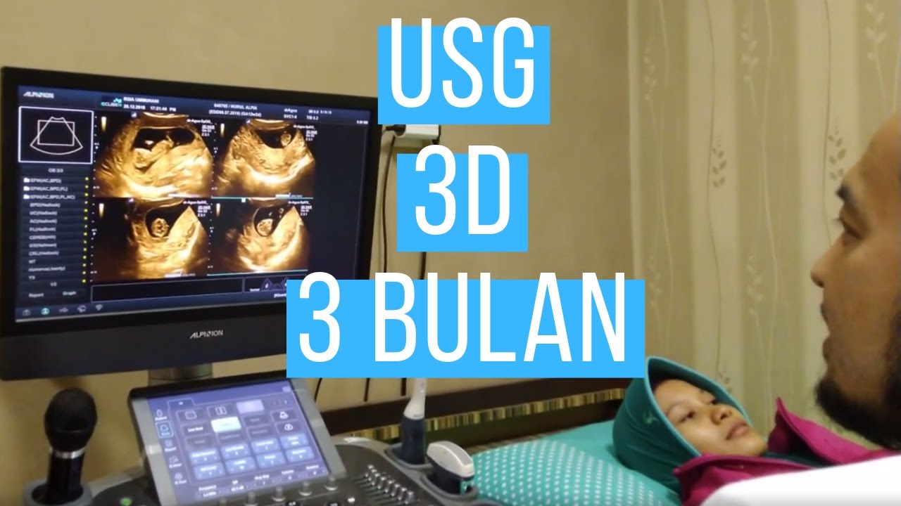 Detail Foto Usg 3 Bulan Nomer 16