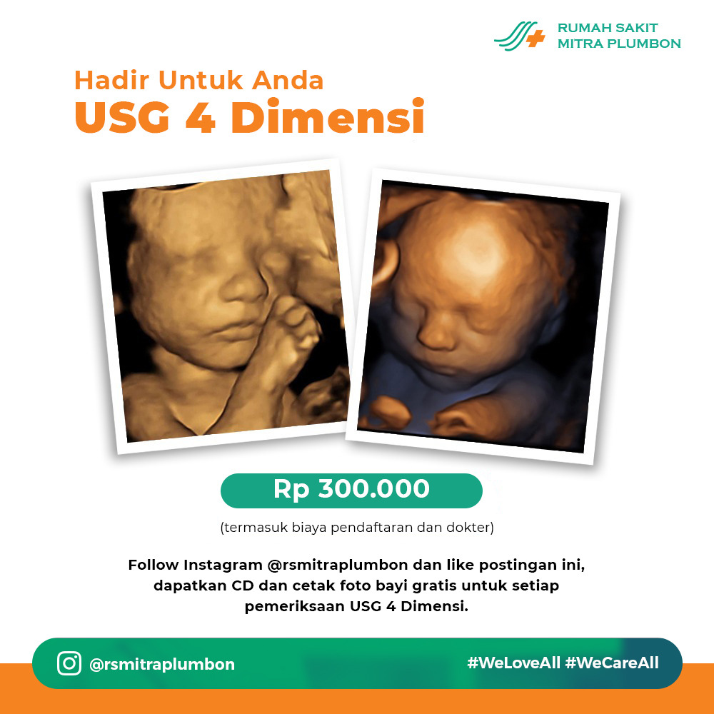 Detail Foto Usg 4d Nomer 36