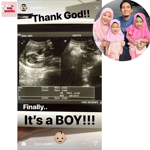 Detail Foto Usg Bayi Laki Laki Nomer 31