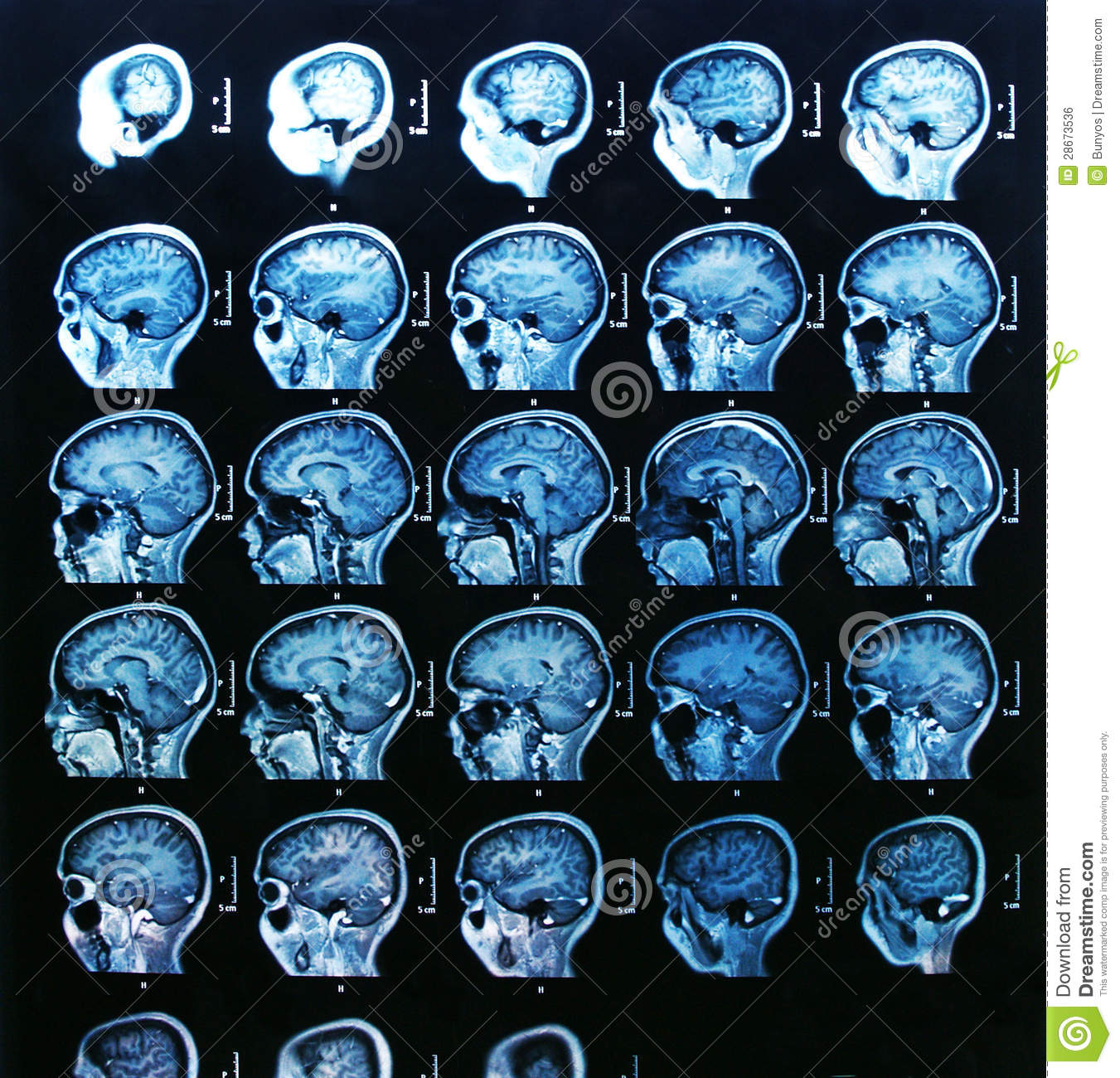 Detail Free Images Of Brain Nomer 49