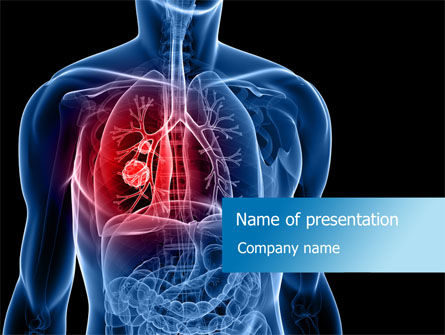 Detail Free Lung Powerpoint Templates Nomer 10