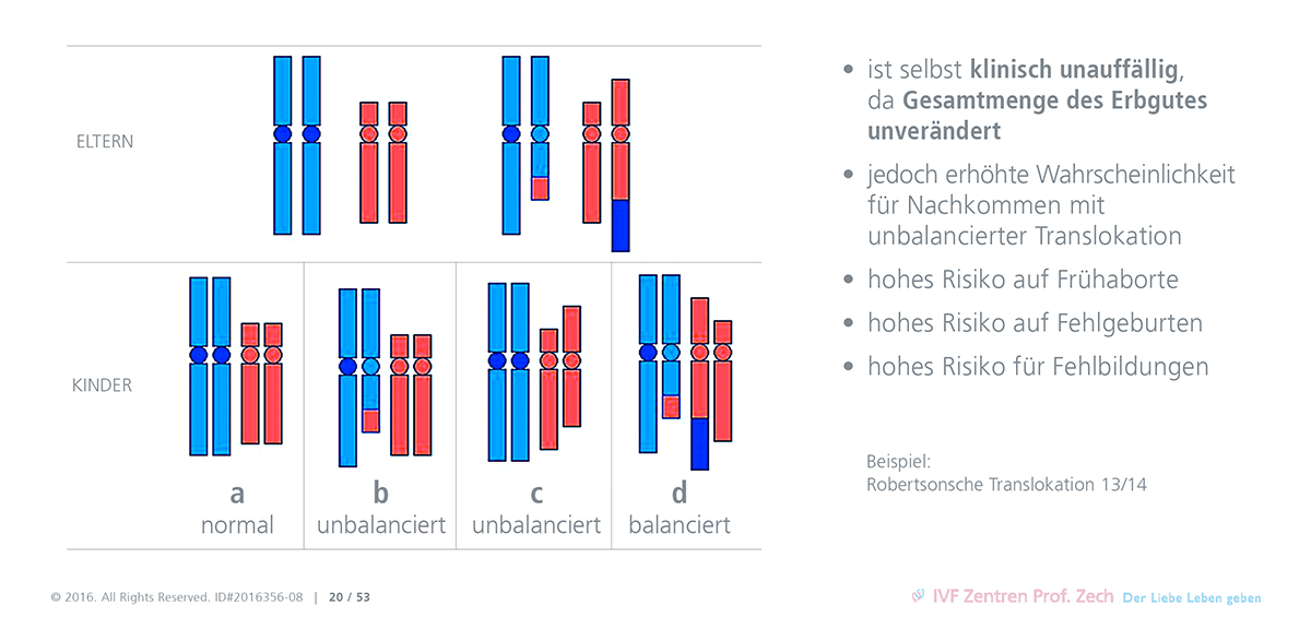 Robertsonsche Translokation - KibrisPDR