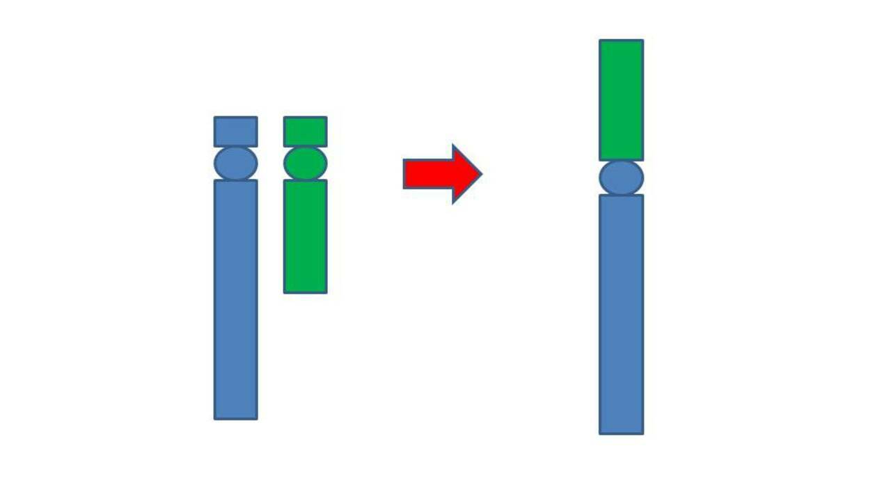 Detail Robertsonsche Translokation Nomer 6