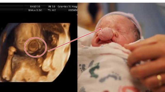 Detail Gambar Aborsi Bayi Nomer 24