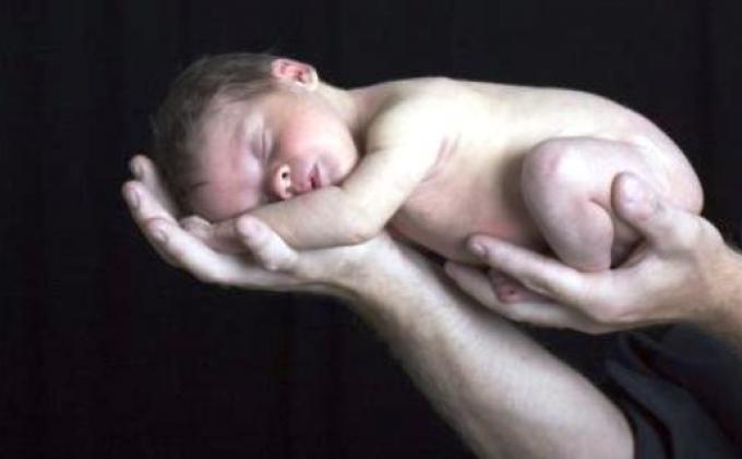Detail Gambar Aborsi Bayi Nomer 27
