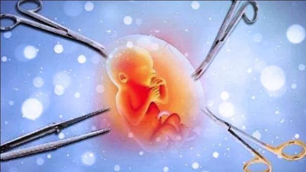 Detail Gambar Aborsi Bayi Nomer 8