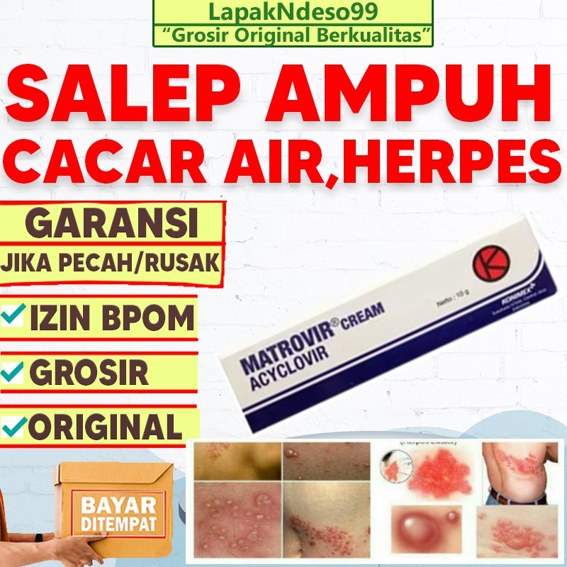 Detail Gambar Acyclovir Salep Nomer 41