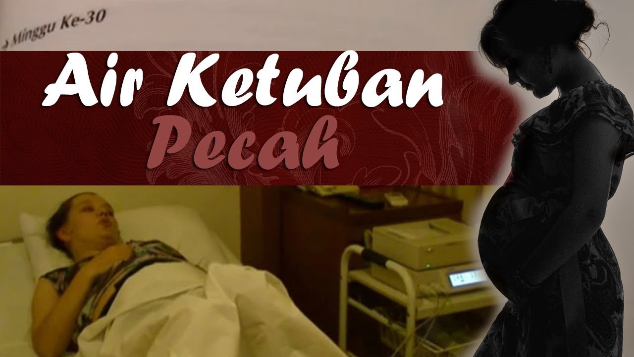 Detail Gambar Air Ketuban Pecah Nomer 55