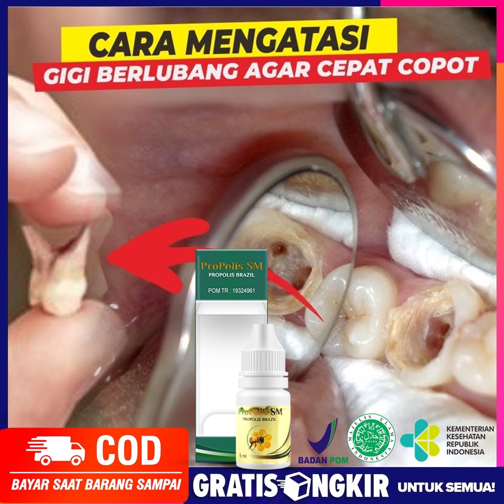 Detail Gambar Akar Gigi Nomer 29