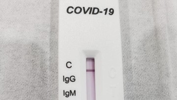 Detail Gambar Alat Rapid Test Nomer 2