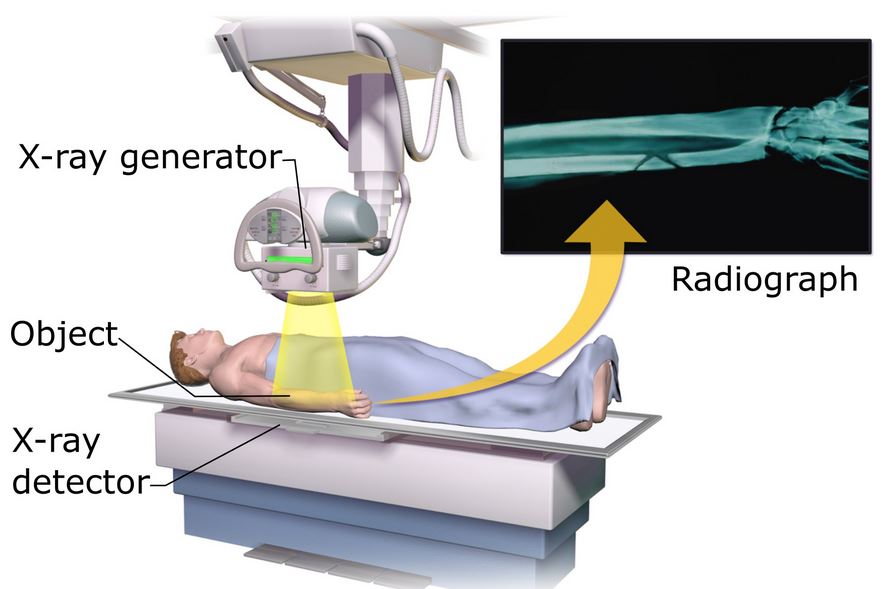 Detail Gambar Alat X Ray Nomer 12