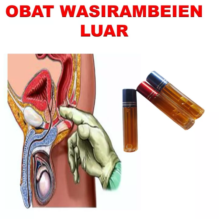 Detail Gambar Ambeien Luar Nomer 10