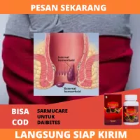 Detail Gambar Ambeien Ringan Nomer 31