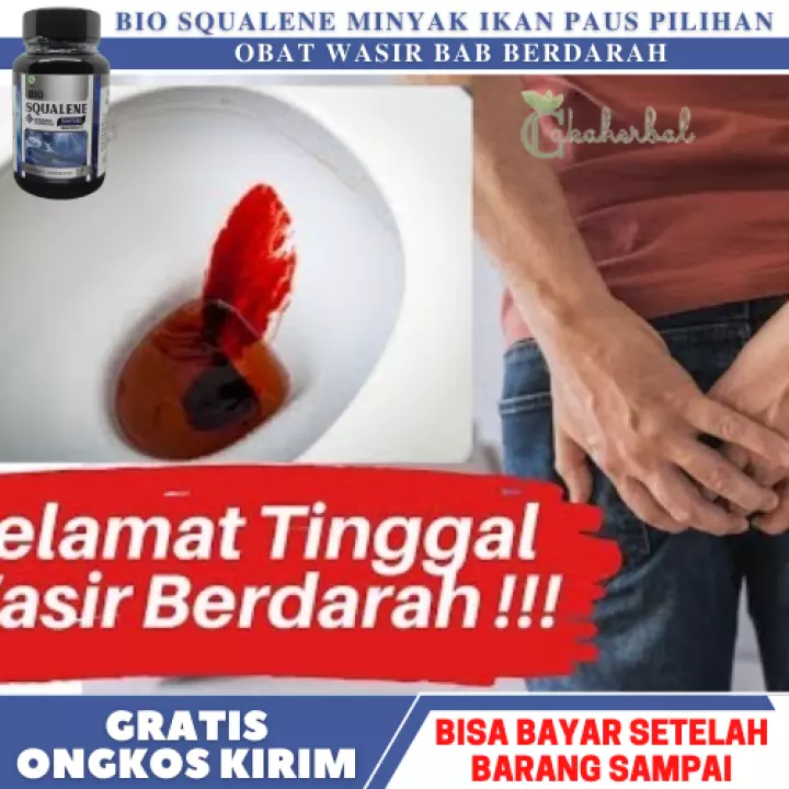 Detail Gambar Ambeien Ringan Nomer 45