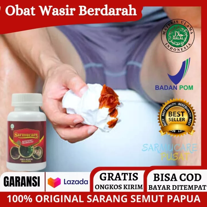 Detail Gambar Ambeien Ringan Nomer 55