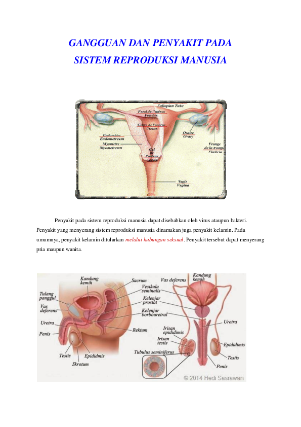 Detail Gambar Amenore Primer Gambar Penyakit Kriptorkidisme Nomer 13