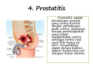 Detail Gambar Amenore Primer Gambar Penyakit Kriptorkidisme Nomer 15