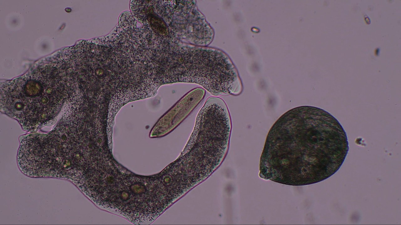 Detail Gambar Amoeba Dan Paramecium Nomer 32