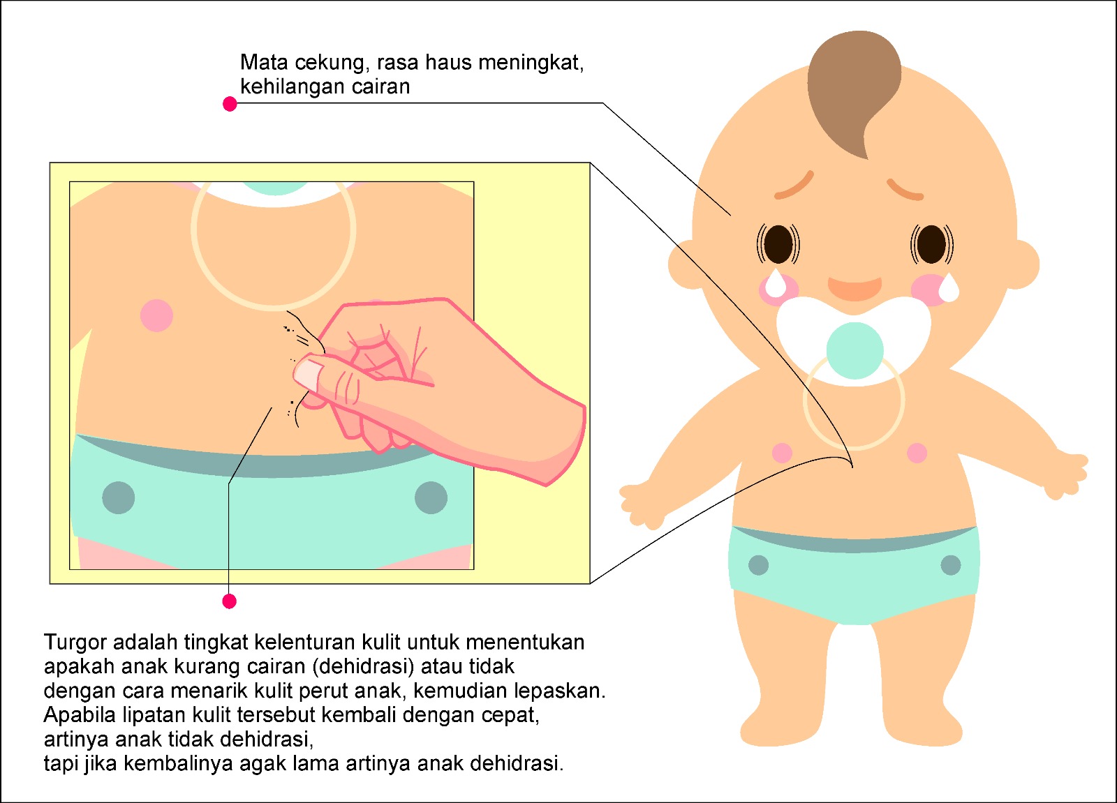 Detail Gambar Anak Diare Nomer 12