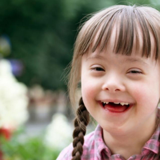Detail Gambar Anak Down Syndrome Nomer 3