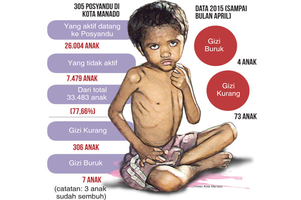 Detail Gambar Anak Gizi Buruk Nomer 26