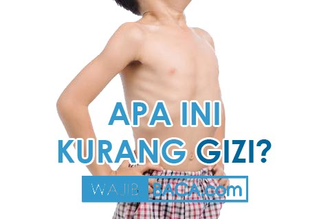 Detail Gambar Anak Kurus Kurang Gizi Nomer 21