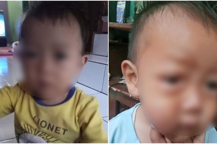 Detail Gambar Anak Sakit Mata Karena Hp Nomer 21