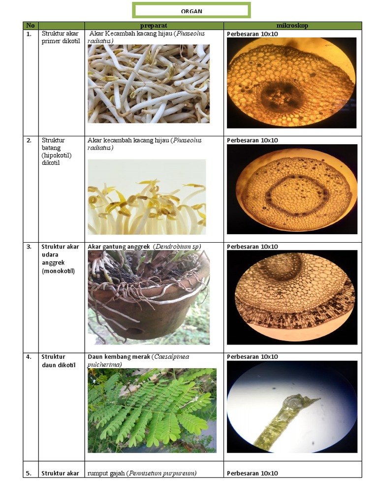 Detail Gambar Anatomi Batang Kacang Hijau Nomer 41
