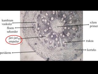 Detail Gambar Anatomi Batang Tumbuhan Nomer 33