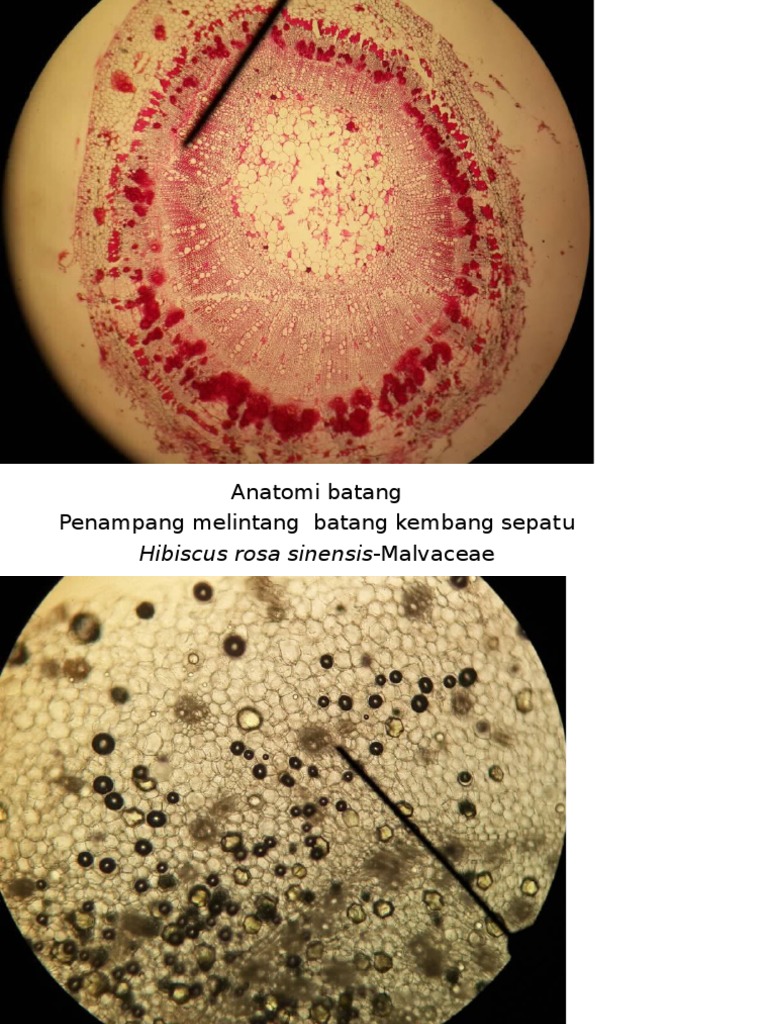 Detail Gambar Anatomi Bunga Kembang Sepatu Nomer 49