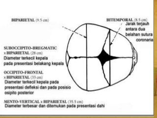 Detail Gambar Anatomi Kepala Bayi Nomer 26