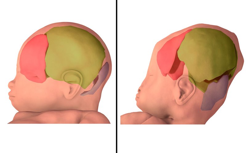 Detail Gambar Anatomi Kepala Bayi Nomer 28