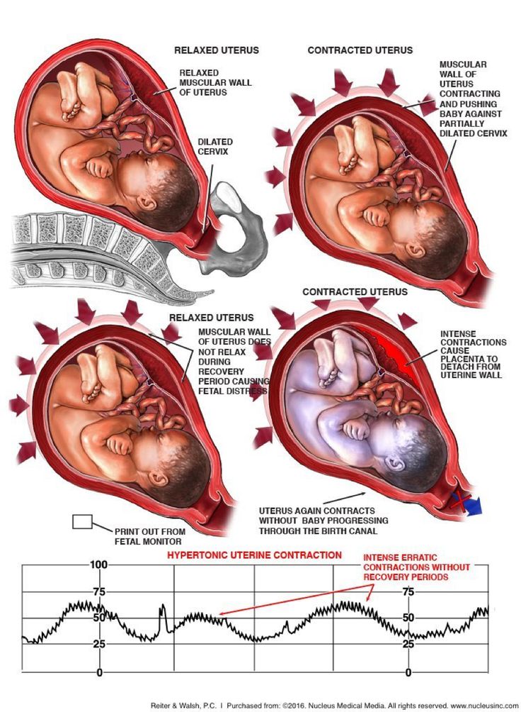 Detail Gambar Anatomi Kepala Bayi Nomer 41