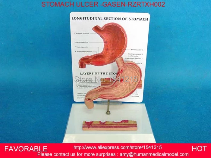Download Gambar Anatomi Lambung Nomer 54