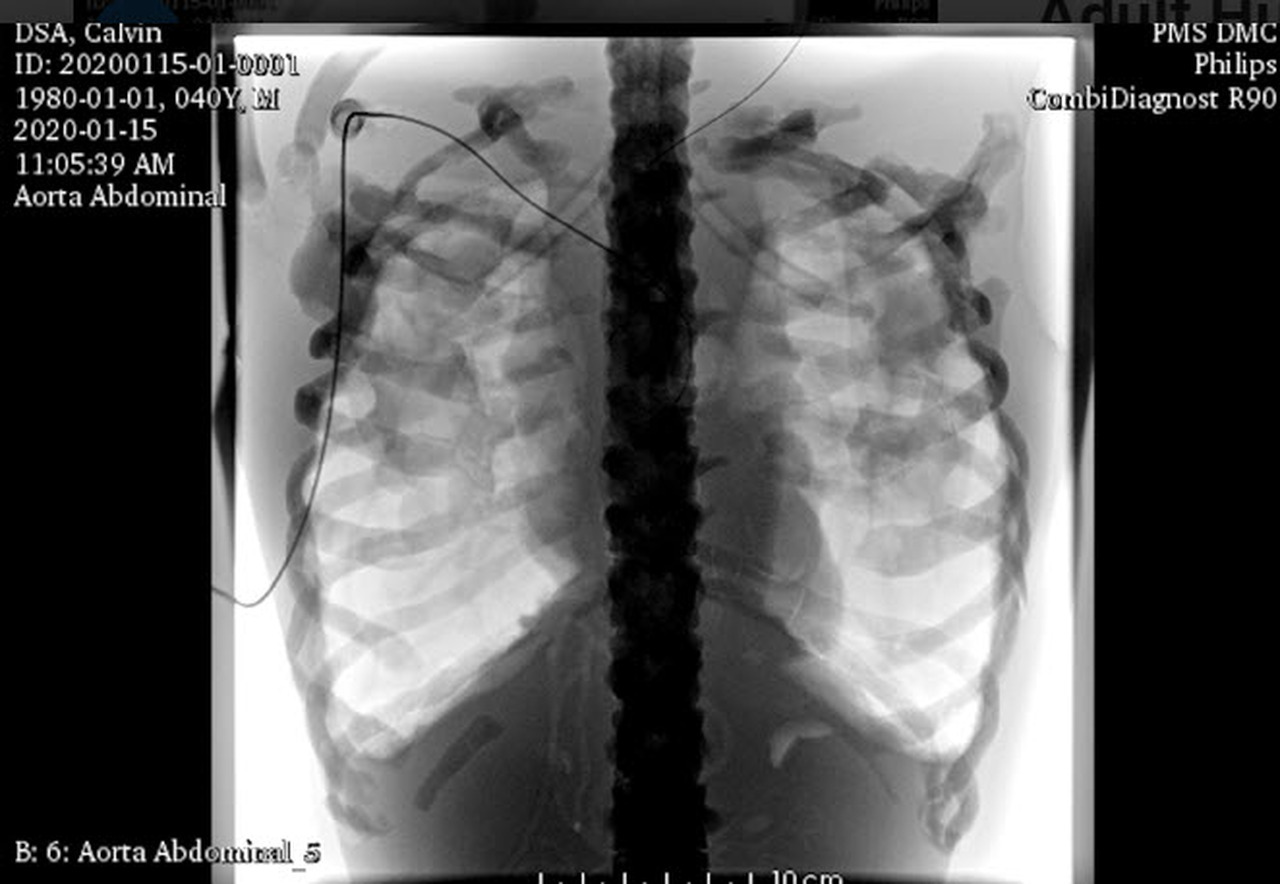 Detail Calvin Yang Medical Imaging Nomer 27