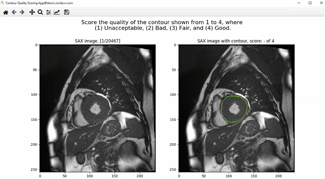 Detail Calvin Yang Medical Imaging Nomer 31