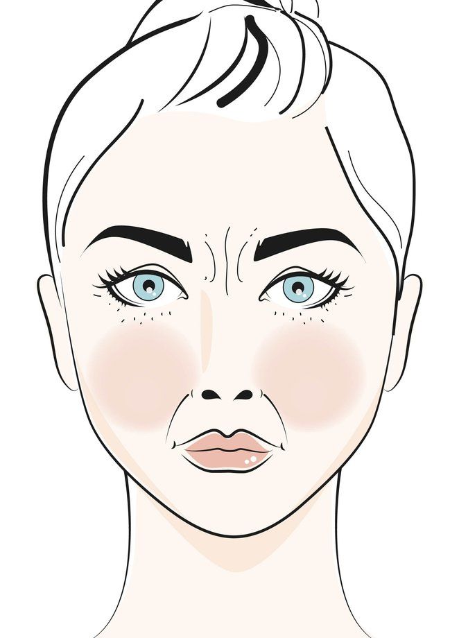 Detail Hautprobleme Im Gesicht Nomer 3