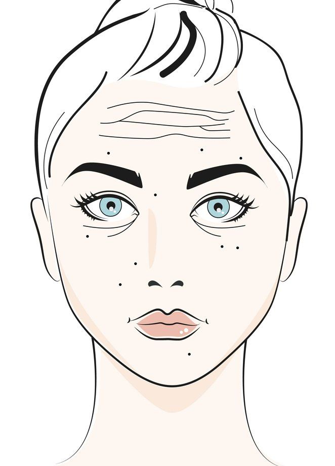 Detail Hautprobleme Im Gesicht Nomer 7