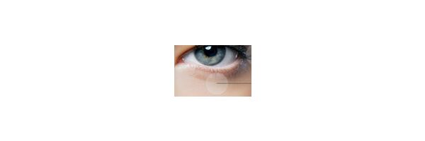 Detail Vitiligo Augen Nomer 26