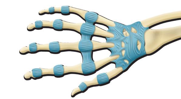 Detail Bruch Mittelhandknochen Nomer 18