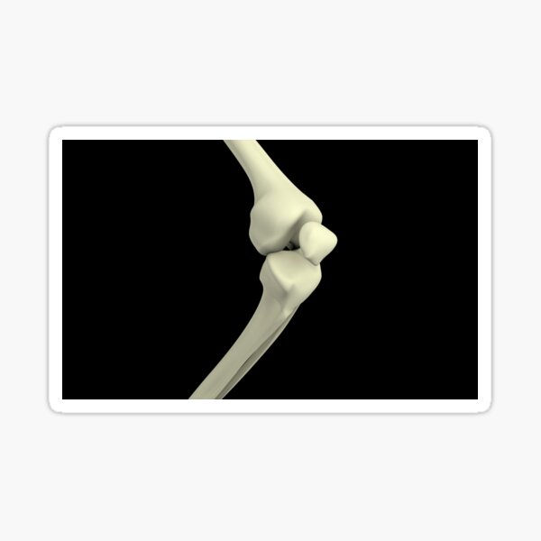 Detail Bruch Mittelhandknochen Nomer 21