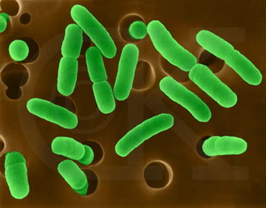Detail Gambar Archaebacteria Metanogen Nomer 17