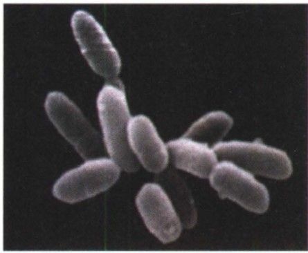 Detail Gambar Archaebacteria Metanogen Nomer 5