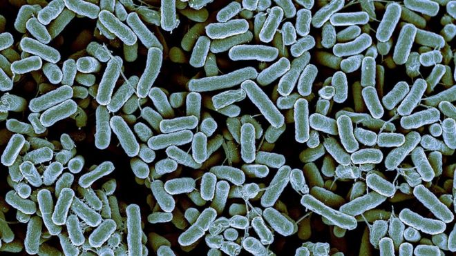 Detail Gambar Archaebacteria Metanogen Nomer 36
