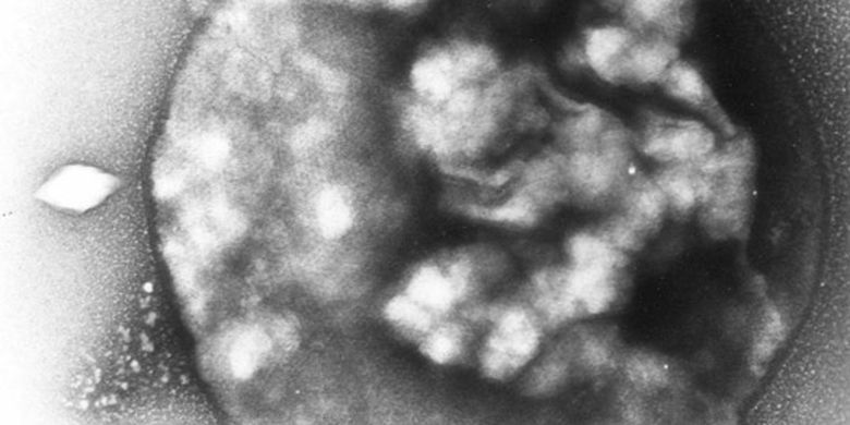 Detail Gambar Archaebacteria Metanogen Nomer 52