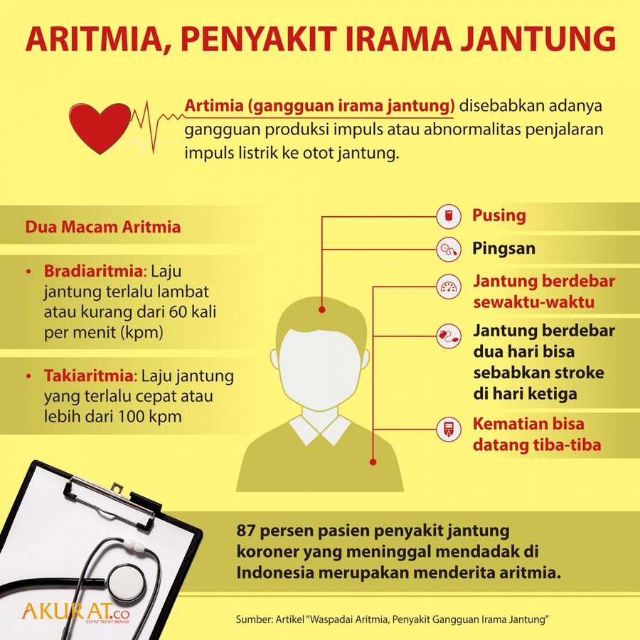 Detail Gambar Aritmia Jantung Nomer 10