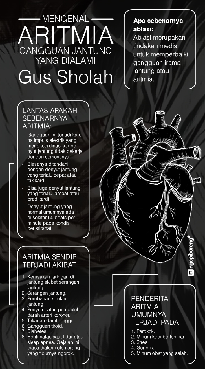 Detail Gambar Aritmia Jantung Nomer 34