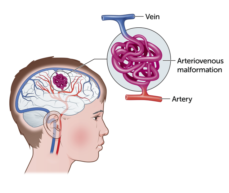 Detail Gambar Arteri Dan Vena Nomer 42